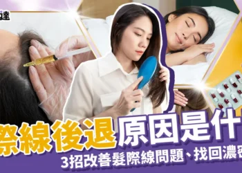 髮際線後退原因是什麼？3招改善髮際線問題、找回濃密秀髮！