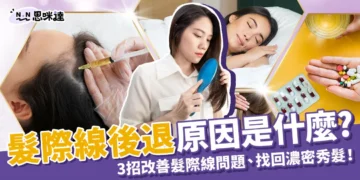 髮際線後退原因是什麼？3招改善髮際線問題、找回濃密秀髮！