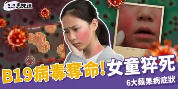 B19病毒奪命！台中11歲女童突發猝死，6大蘋果病症狀不能輕忽