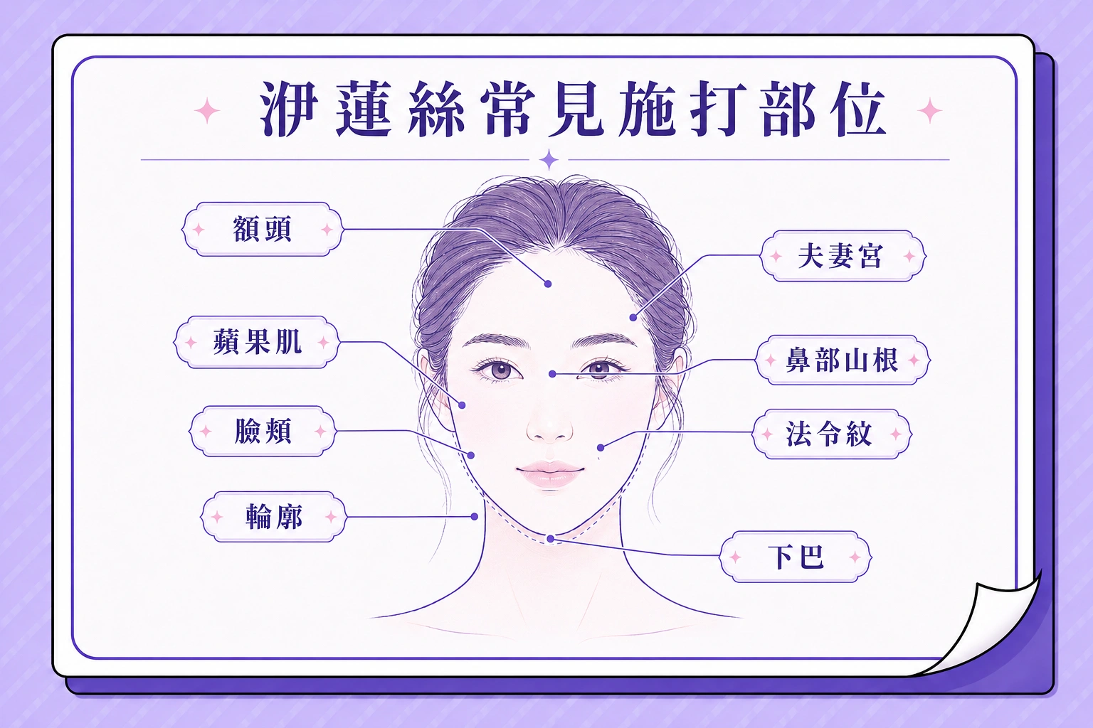 洢蓮絲少女針