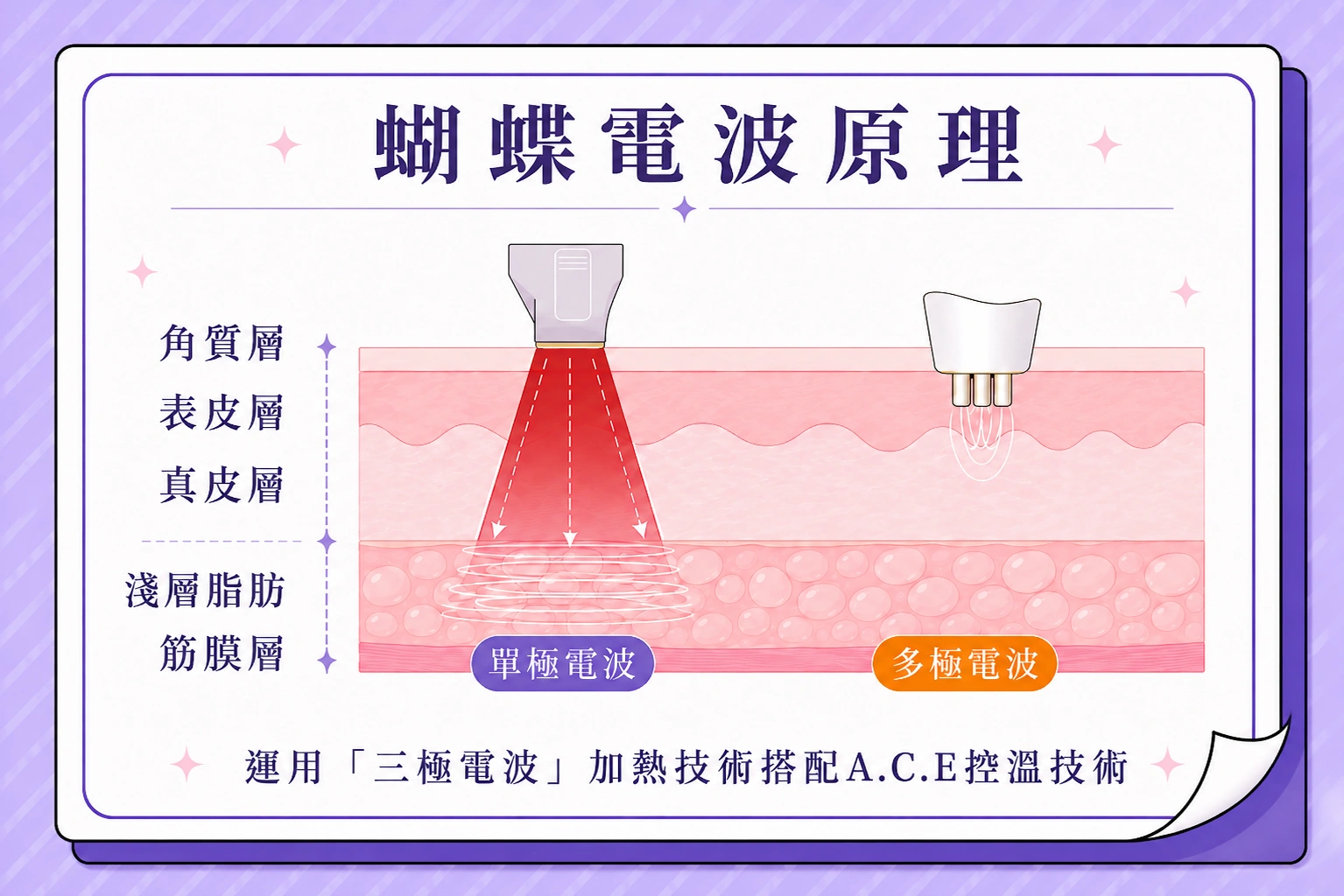 蝴蝶電波