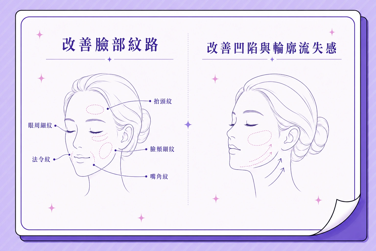 舒顏萃-4D童顏針