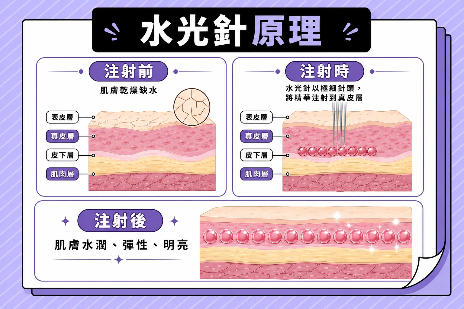 水光針