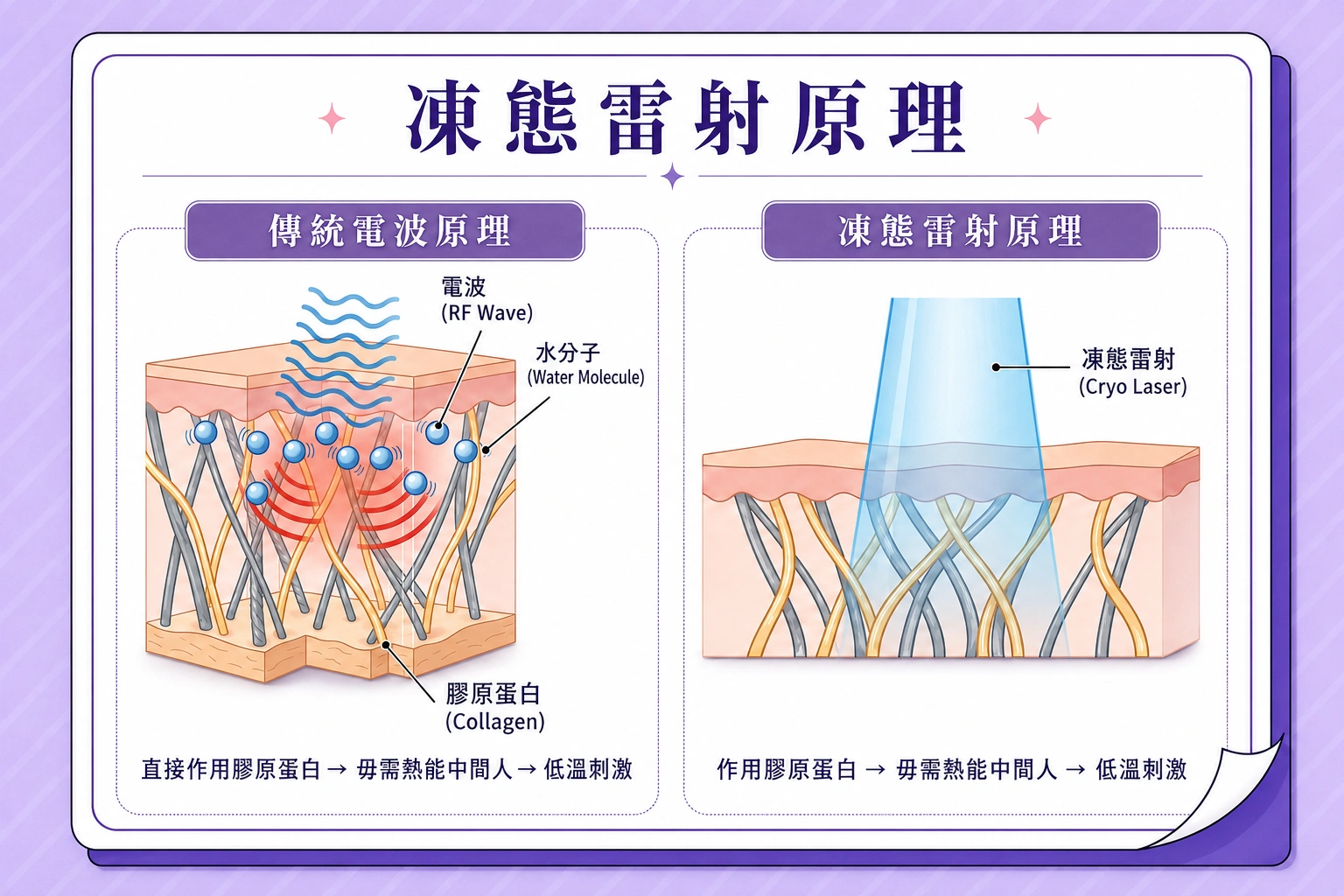 RedTouch Pro凍態雷射
